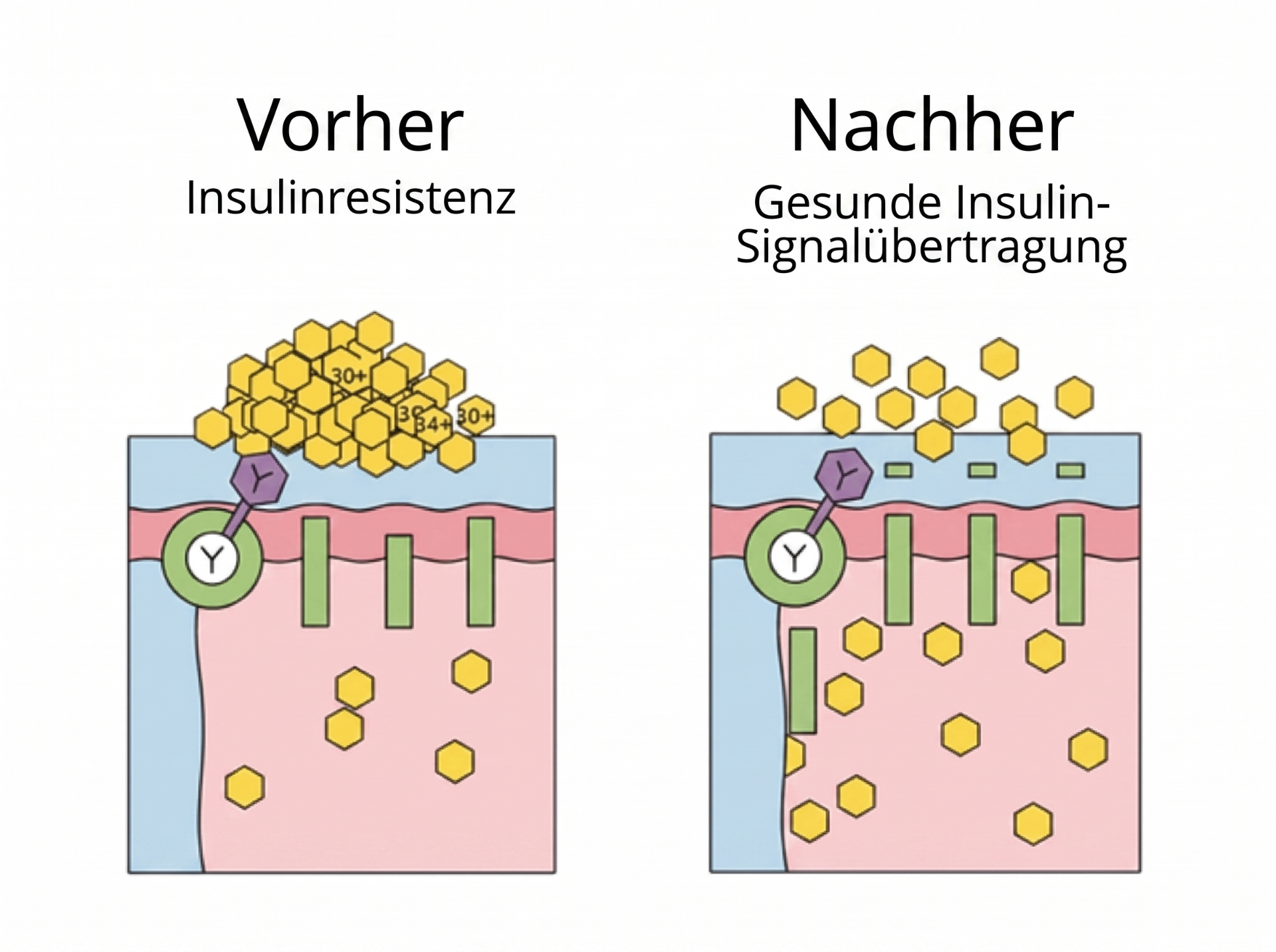 Vorher/Nachher Insulinresistenz